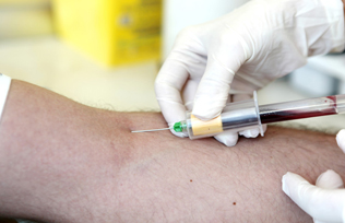 Blood Test Detect Parkinsons