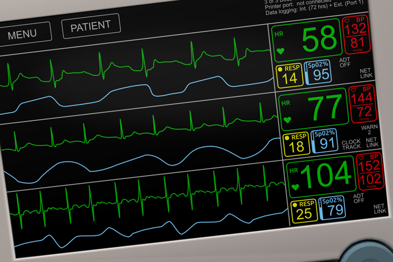 Recognizing and Responding to Changes in Vital Signs - Key Concerns