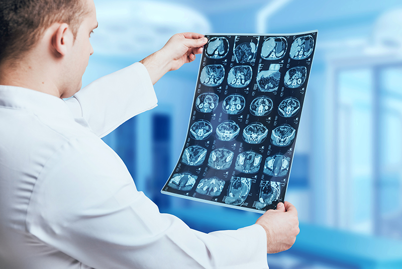 How Radiology Transcription Helps With Structured Reporting